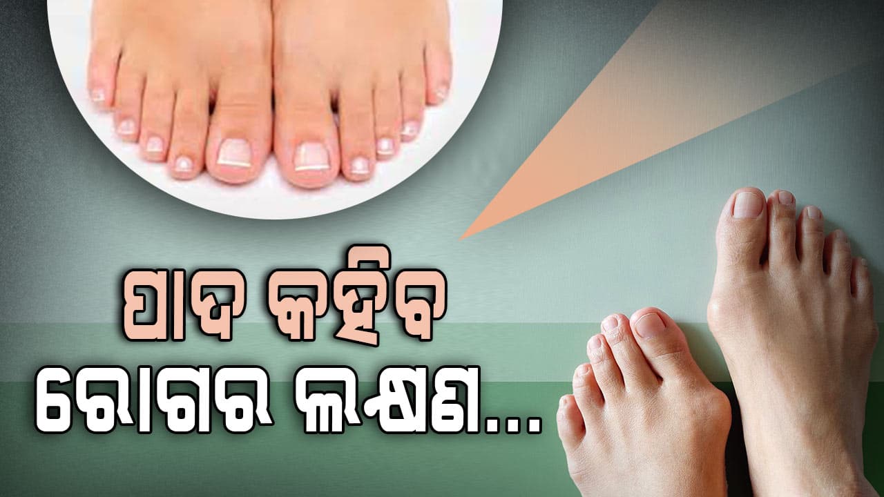 ପାଦ କହିବ ଆପଣଙ୍କୁ କେଉଁ ରୋଗ ହେଇଛି ?