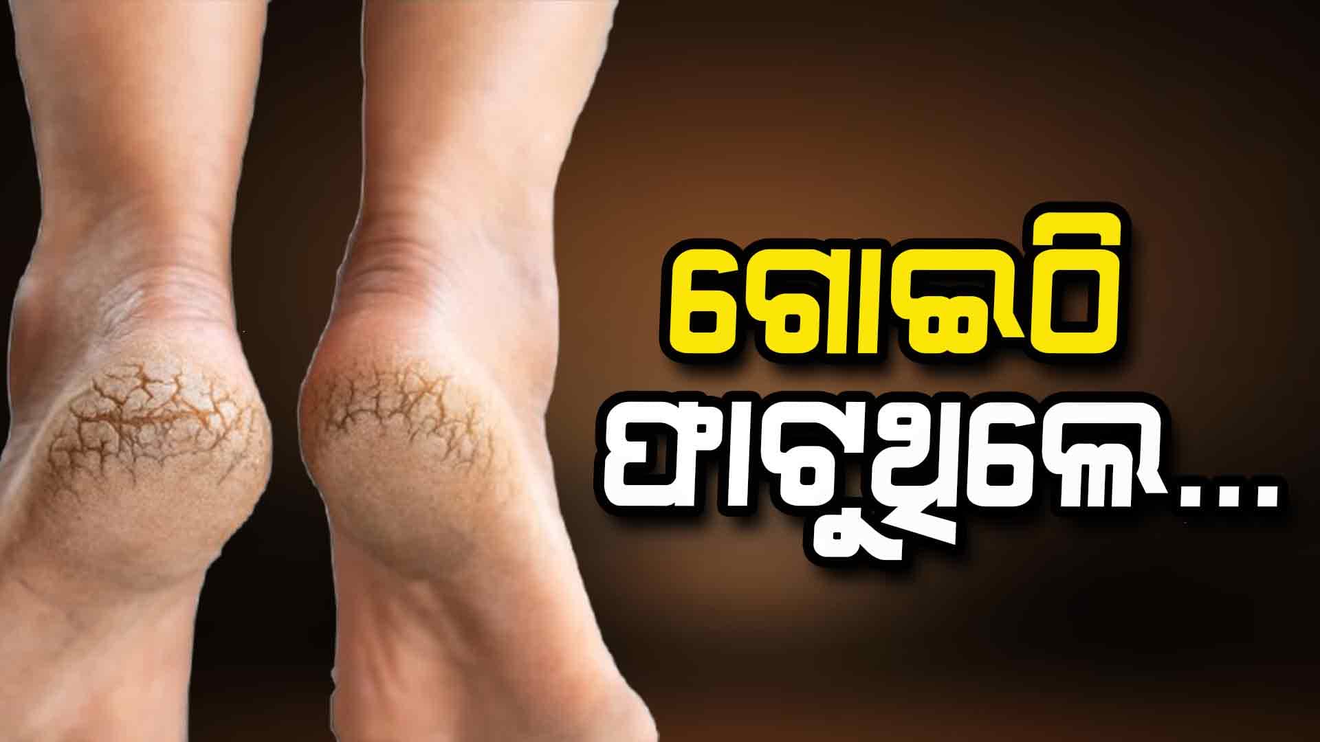 ଶୀତ ଦିନେ ରଖନ୍ତୁ ଗୋଇଠିର ଯତ୍ନ...