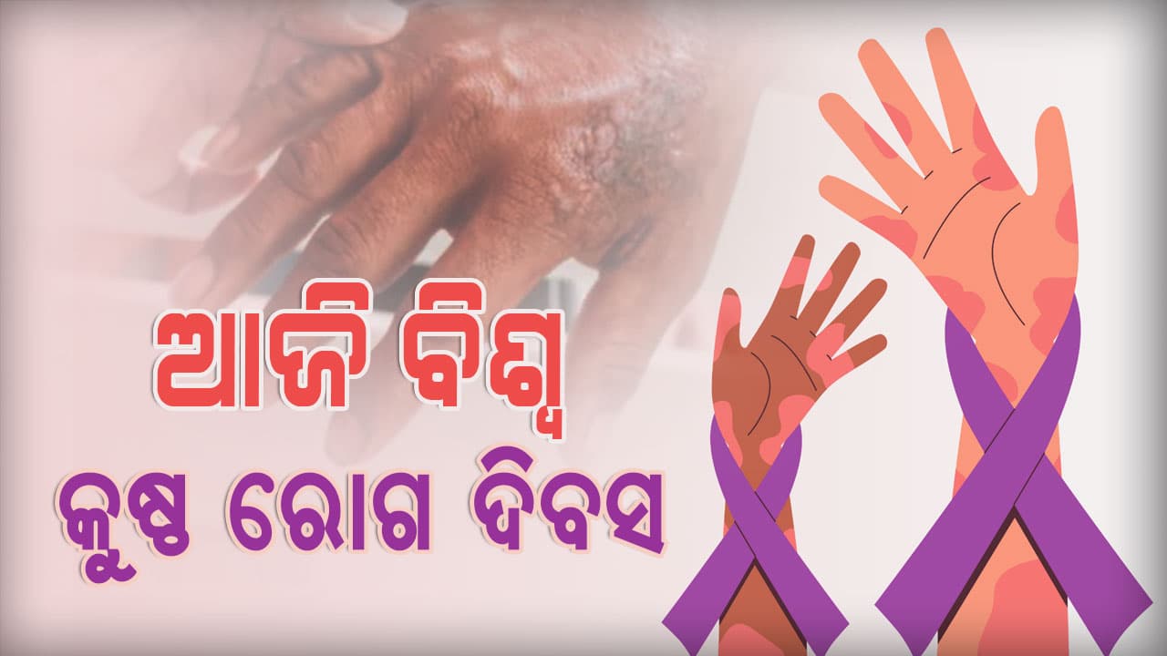 ଗାନ୍ଧୀଙ୍କ ତିରୋଧାନ ଦିବସରେ ସାରା ବିଶ୍ବ ପାଳୁଛି କୁଷ୍ଠ ରୋଗ ଦିବସ 