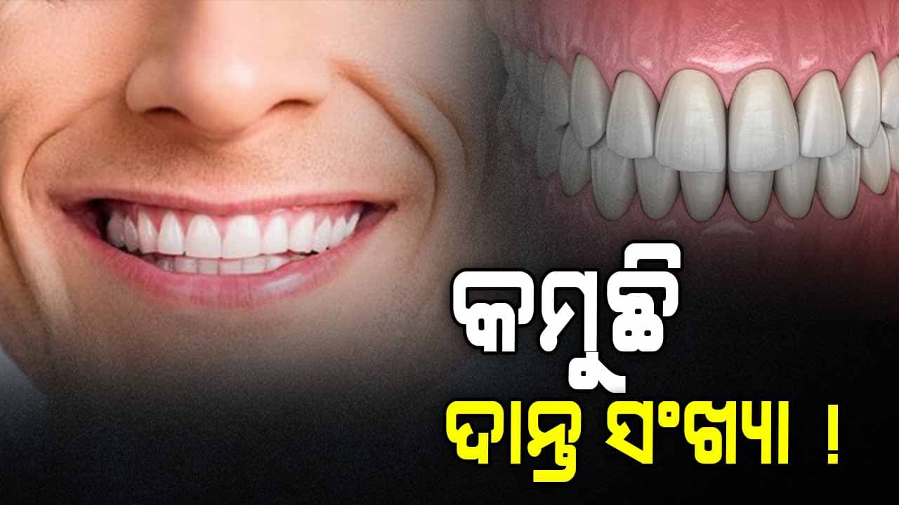 ପାଟିରେ କମୁଛି ଦାନ୍ତ ସଂଖ୍ୟା,୩୨ ନୁହେଁ ୨୮ !