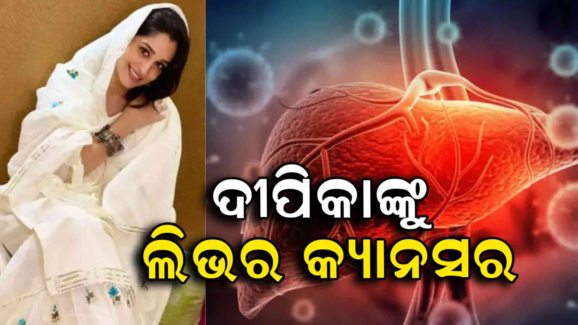 ଷ୍ଟେଜ ୨ ଯକୃତ କର୍କଟ ସହିତ ଲଢୁଛନ୍ତି ଦୀପିକା କକ୍କର