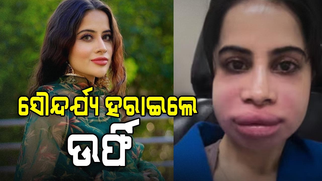 ଲିପ୍‌ ଫିଇଲର କରି ଚିନ୍ତାରେ ଉର୍ଫି, ଫ୍ୟାନ୍ସ କହିଲେ ଏମିତି କଣ ହୋଇଗଲା ?