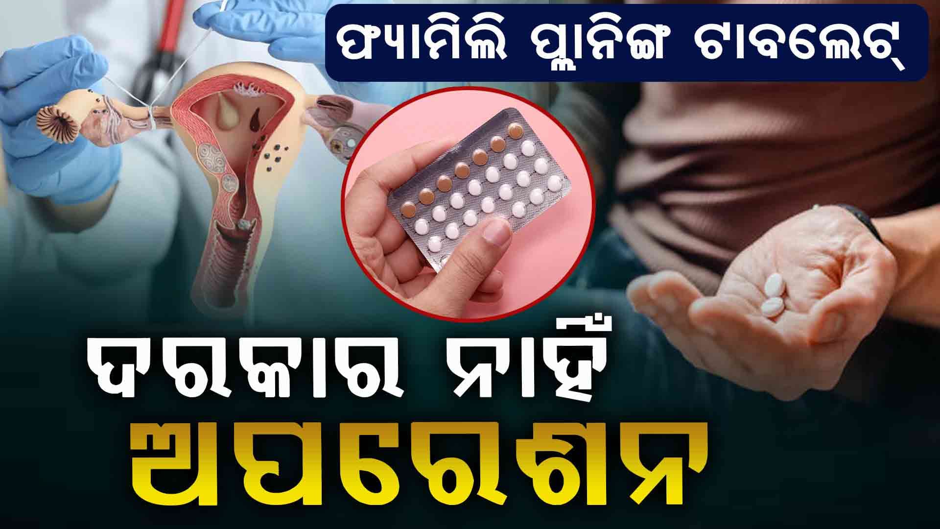 ପୁରୁଷଙ୍କ କ୍ଷେତ୍ରରେ ପରିବାର ନିୟନ୍ତ୍ରଣ-ବିନା ଅସ୍ତ୍ରୋପଚାରରେ