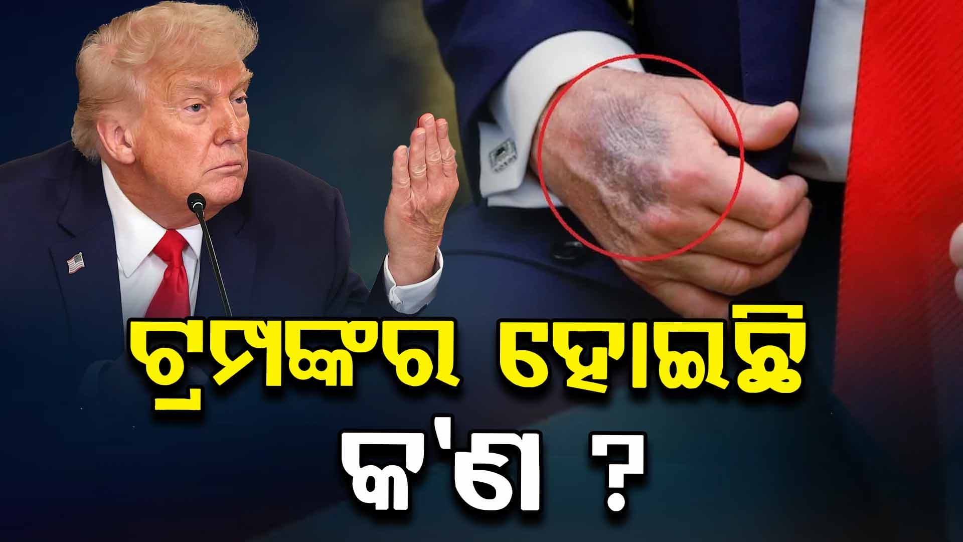 Donald Trump Health: ଠିକ୍ ଅଛି ତ ଆମେରିକା ରାଷ୍ଟ୍ରପତିଙ୍କ ସ୍ବାସ୍ଥ୍ୟବସ୍ଥା ? ଟ୍ରମ୍ପଙ୍କ ହାତରେ ପୁଣି ଦେଖିବାକୁ ମିଳିଲା ଅଜବ ଚିହ୍ନ