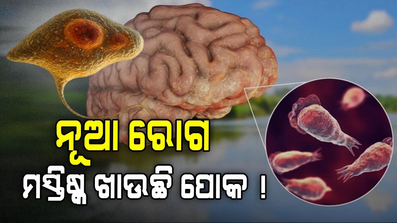 Brain Eating Amoeba: କରୋନା ଭଳି ବଢ଼ିଲାଣି ଭୟ, ବ୍ୟାପିଲା ମସ୍ତିଷ୍କ ଖିଆ ରୋଗ ! ୧୮ ମଲେଣି...