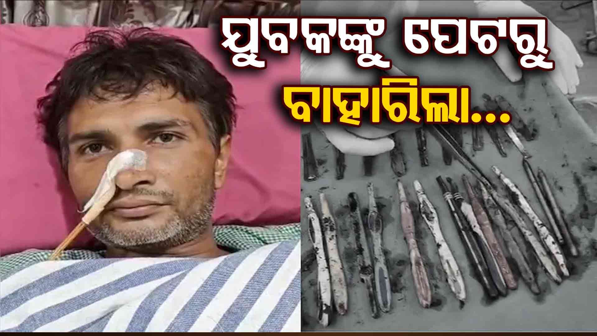ଆଶ୍ଚର୍ଯ୍ୟଜନକ ଘଟଣା: ଏହି କାରଣରୁ ଯୁବକ ଖାଉଥିଲେ ଚାମଚ ଆଉ ଟୁଥବ୍ରଶ