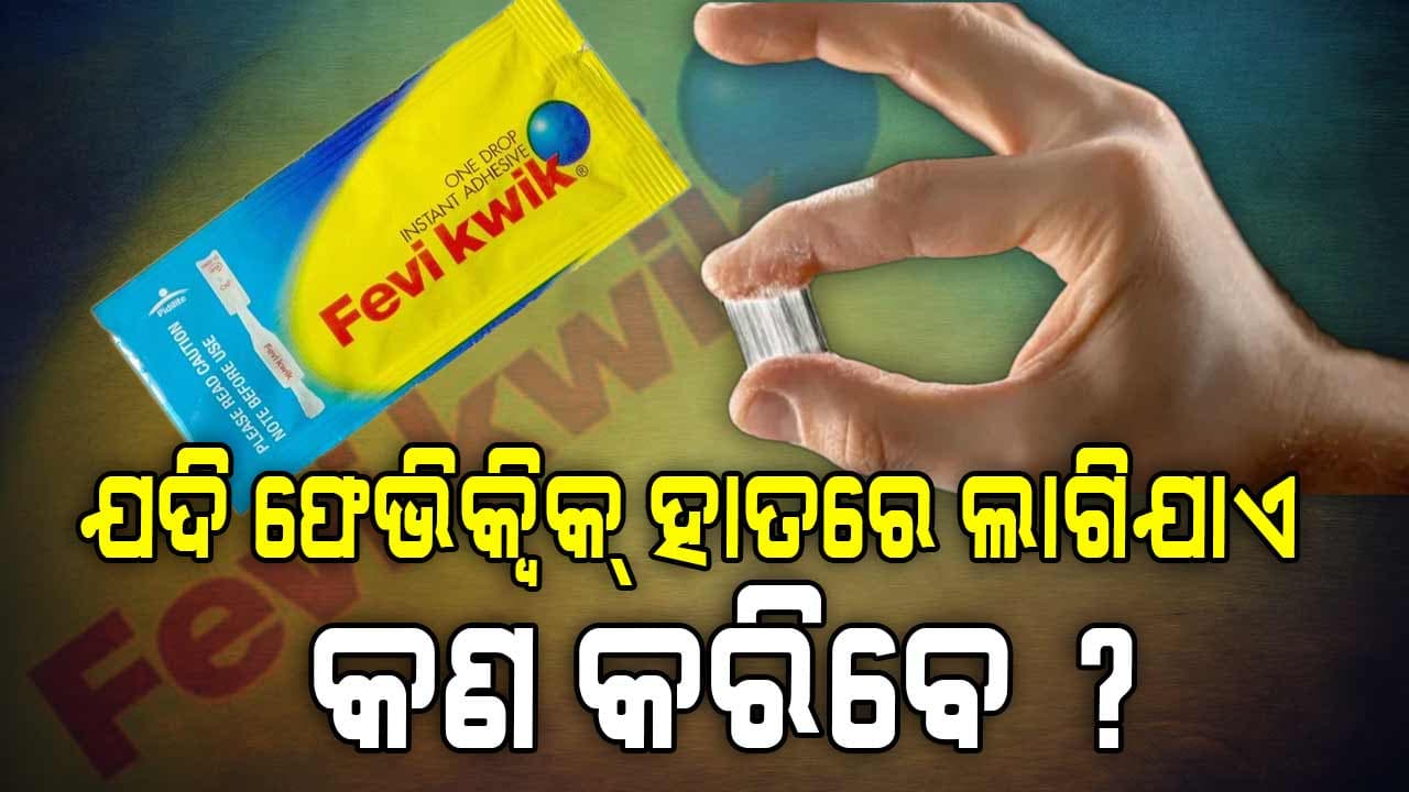 ଫେଭିକ୍ୱିକ୍ ହାତରେ ଲାଗିଥିଲେ ସଙ୍ଗେ ସଙ୍ଗେ କରନ୍ତୁ ଏମିତି...