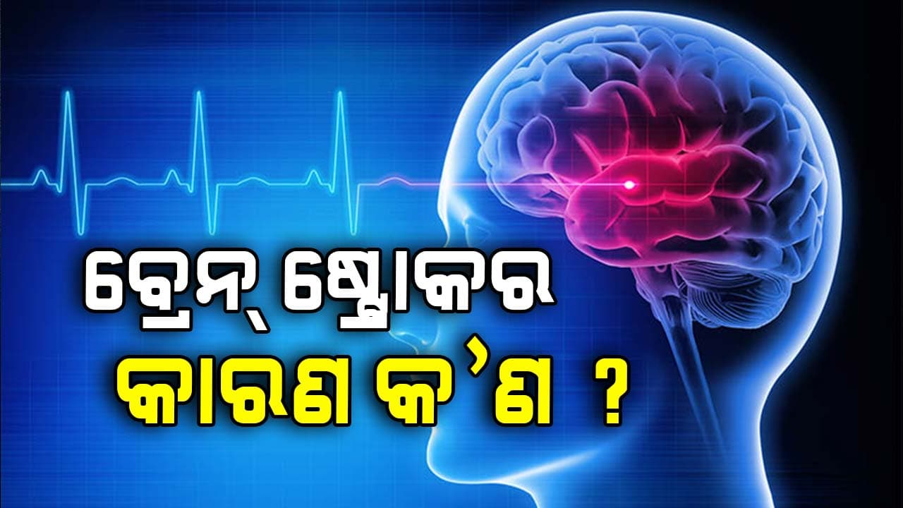 ଜାଣିରଖନ୍ତୁ, ବ୍ରେନ ଷ୍ଟ୍ରୋକ ପୂର୍ବରୁ ଦେଖାଯାଏ ଏସବୁ ଲକ୍ଷଣ