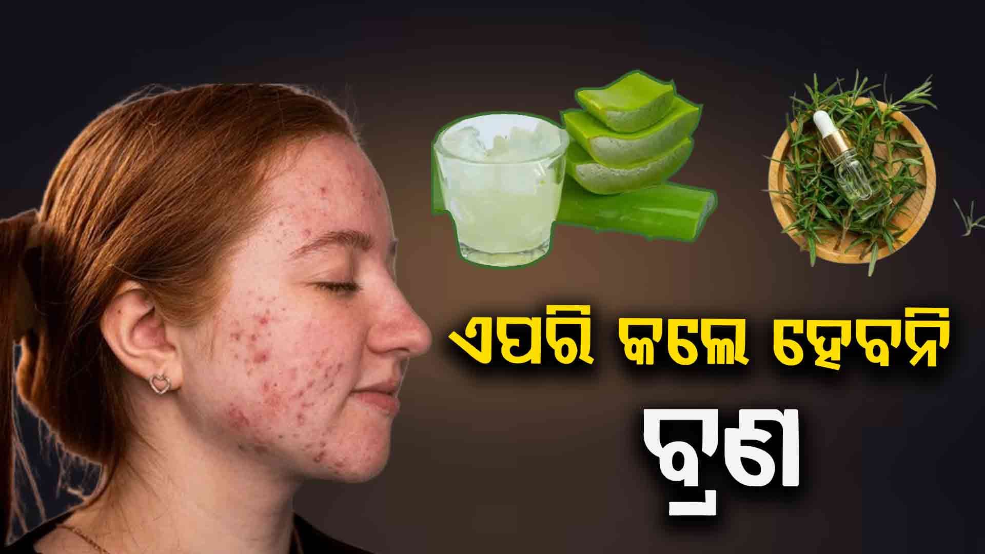 ବ୍ରଣ ଦୂର କରିବାର ସହଜ ଘରୋଇ ଉପଚାର ଜାଣନ୍ତୁ...