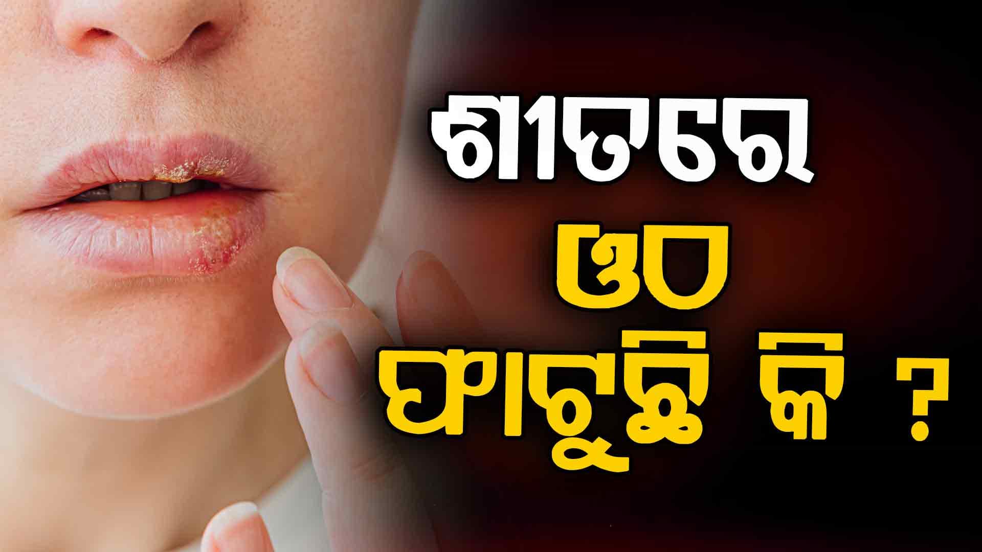ଶୀତ ଦିନେ ଓଠକୁ କେମିତି ରଖିବେ କୋମଳ ?