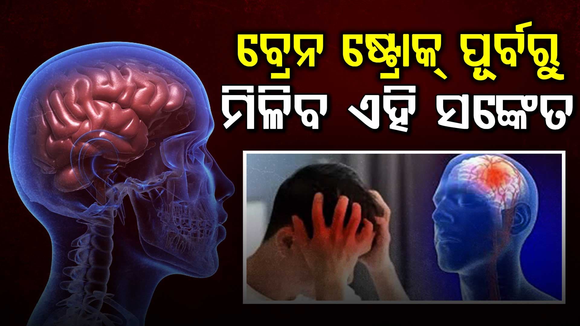 ବ୍ରେନ୍ ଷ୍ଟ୍ରୋକର ୫ଟି ଭୟଙ୍କର ଲକ୍ଷଣ... ''BEFAST'' ଜାଣିଲେ ବଞ୍ଚିପାରିବ ଜୀବନ