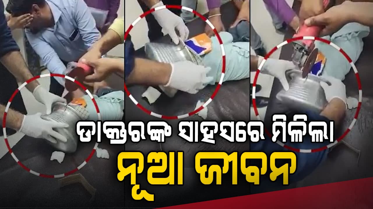 ଖେଳୁଥିବା ବେଳେ ବଡ଼ ଦୁର୍ଘଟଣା: ମୁଣ୍ଡରେ ଫସିଲା ଆଲୁମିନିୟମ୍ ପାତ୍ର 