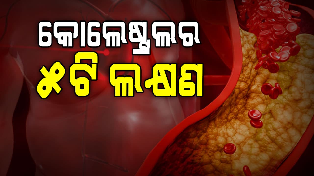 ଅଧିକ କୋଲେଷ୍ଟ୍ରଲ୍ ହେଲେ ଦେଖାଯାଏ ଏହି ସମସ୍ୟା 