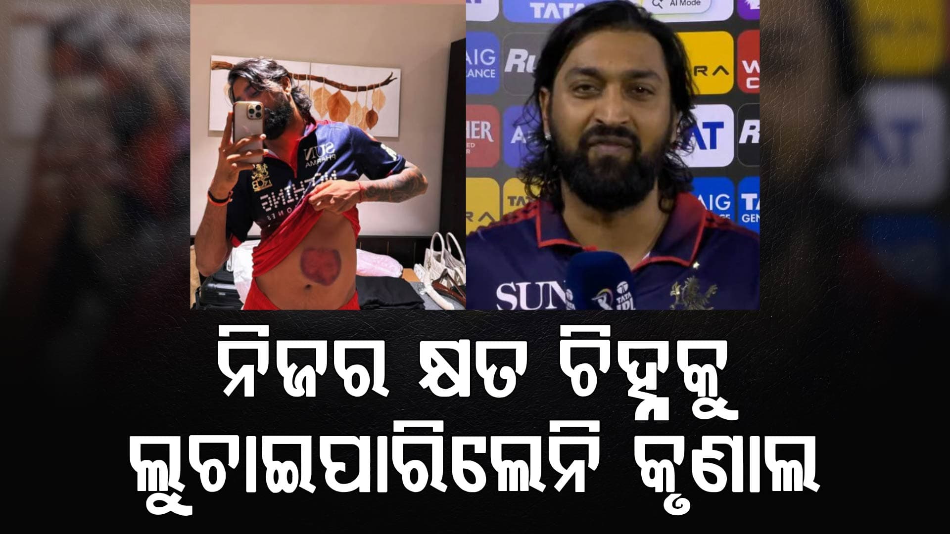 ମ୍ୟାଚ ଜିତିବା ପରେ କୃଣାଲ ପାଣ୍ଡ୍ୟାଙ୍କ ଦେହର କ୍ଷତ ପୋଷ୍ଟ ଭାଇରାଲ, ଏମିତି କହିଲେ ଖେଳାଳି...
