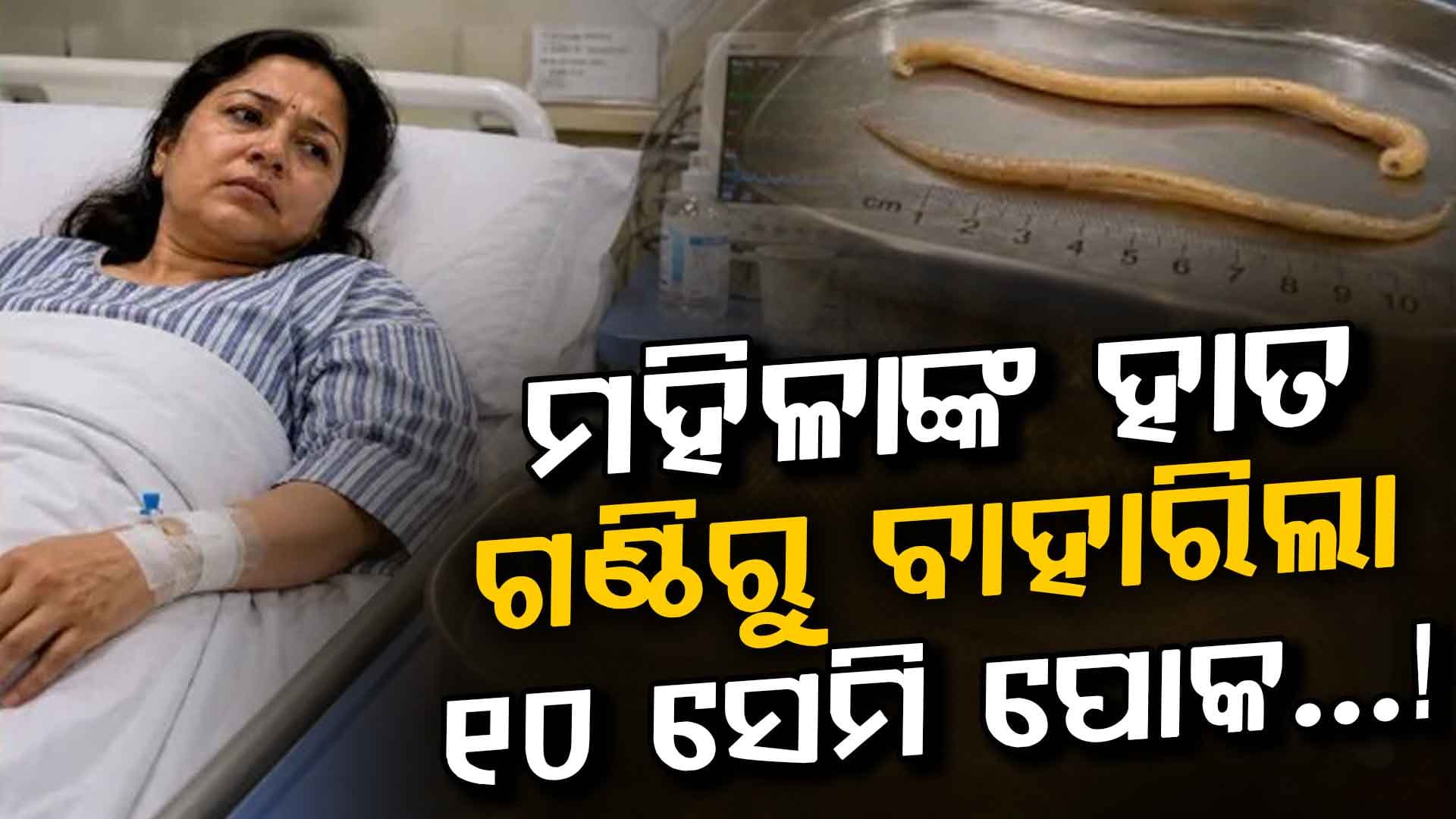 ମହିଳାଙ୍କ ହାତରେ ବଢ଼ୁଥିଲା ଗଣ୍ଠି, ଅପରେସନ ପରେ ବାହାରିଲା ଜୀଅନ୍ତା ପୋକ…ଡାକ୍ତର ବି ହେଲେ ଆଶ୍ଚର୍ଯ୍ୟ