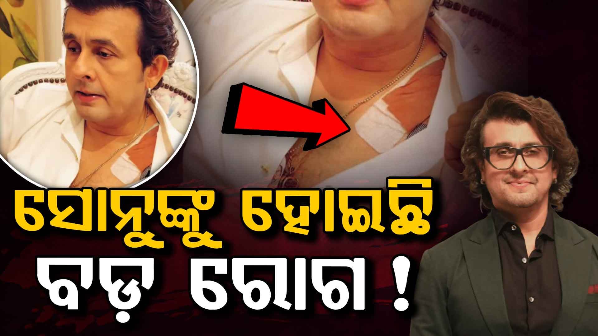 ଗମ୍ଭୀର ସ୍ନାୟୁ ରୋଗ ସହିତ ସଂଘର୍ଷ କରୁଛନ୍ତି ସୋନୁ: ଆଉ ଗୀତ ଗାଇପାରିବେନି ଗୀତ !