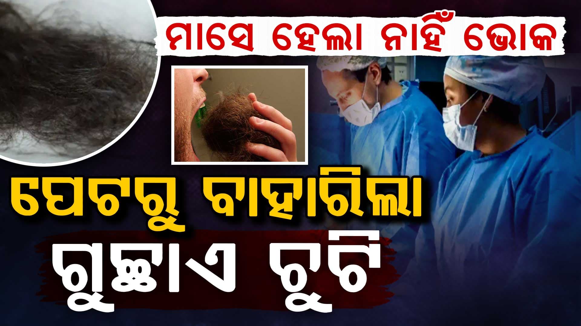 ଅସହ୍ୟ ଯନ୍ତ୍ରଣାକୁ ଭୋକ ଗାୟବ; ପେଟରୁ ବାହାରିଲା ଗୁଚ୍ଛାଏ ଚୁଟି..