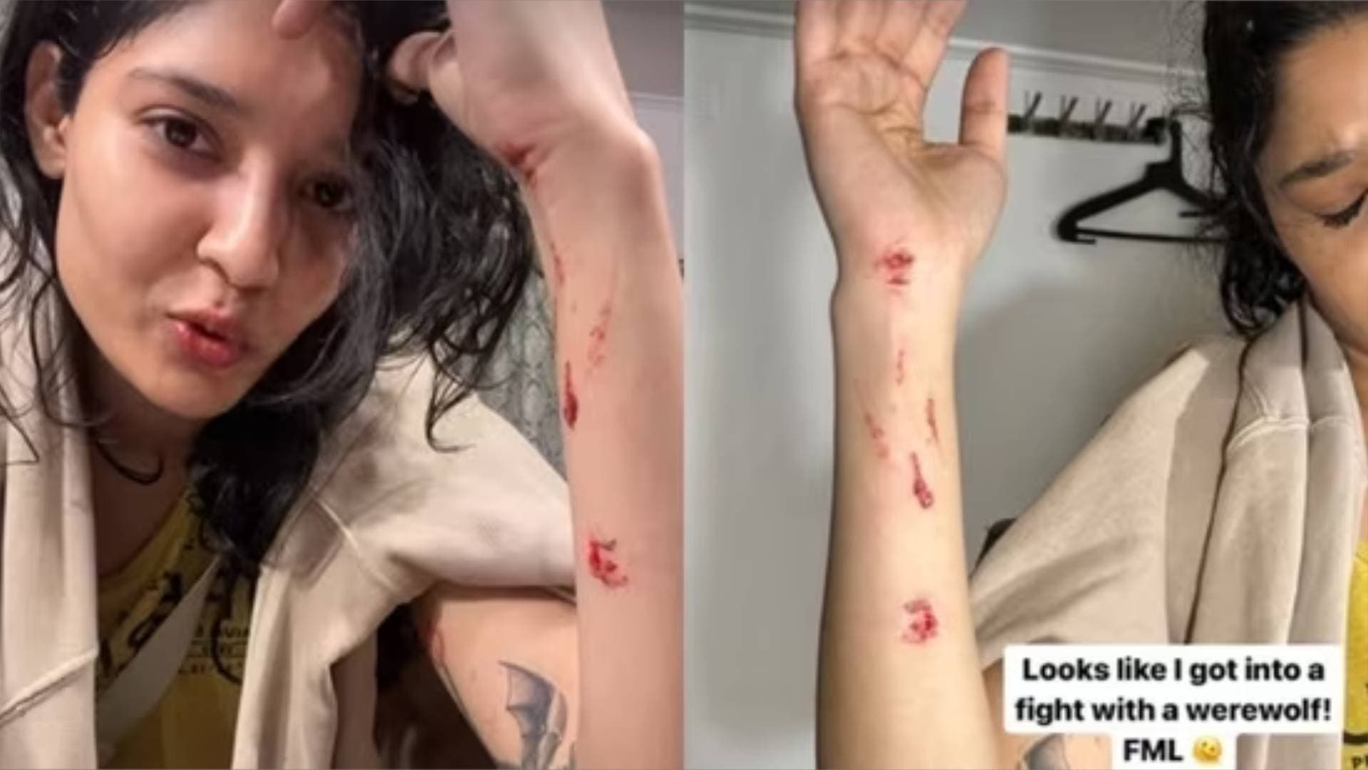 'Thalaivar 170' Actress Ritika Singh Injured During Shoot