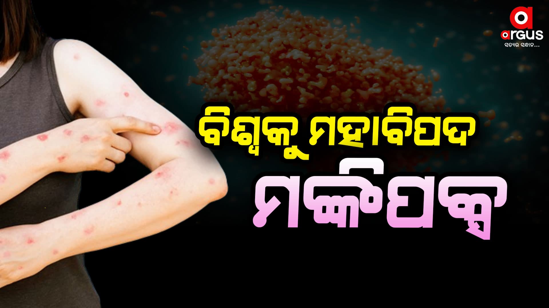 ମଙ୍କିପକ୍ସ ଭାଇରସ୍,ଓଡ଼ିଶାରେ ପ୍ରସ୍ତୁତ ହେଲା INSTANT TESTING KIT