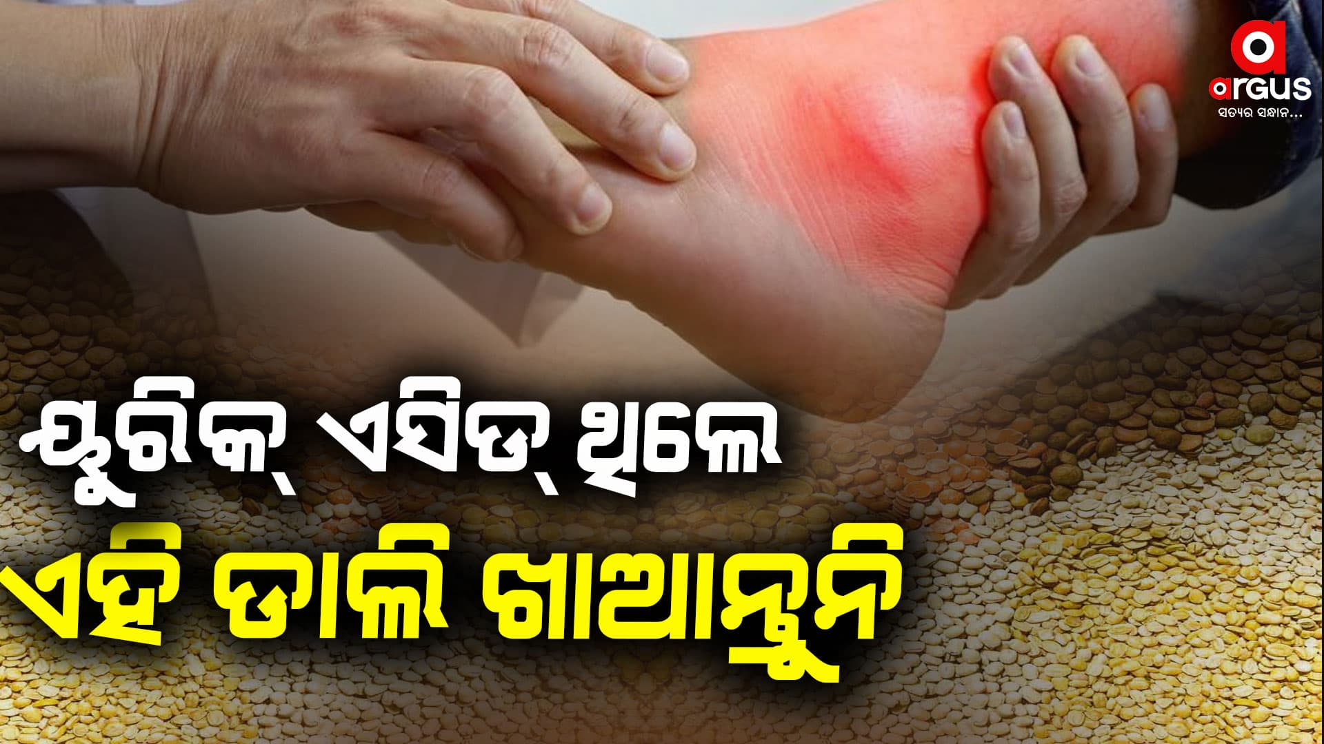 ୟୁରିକ୍ ଏସିଡ୍ କେତେ ରହିବା ଉଚିତ୍ ?