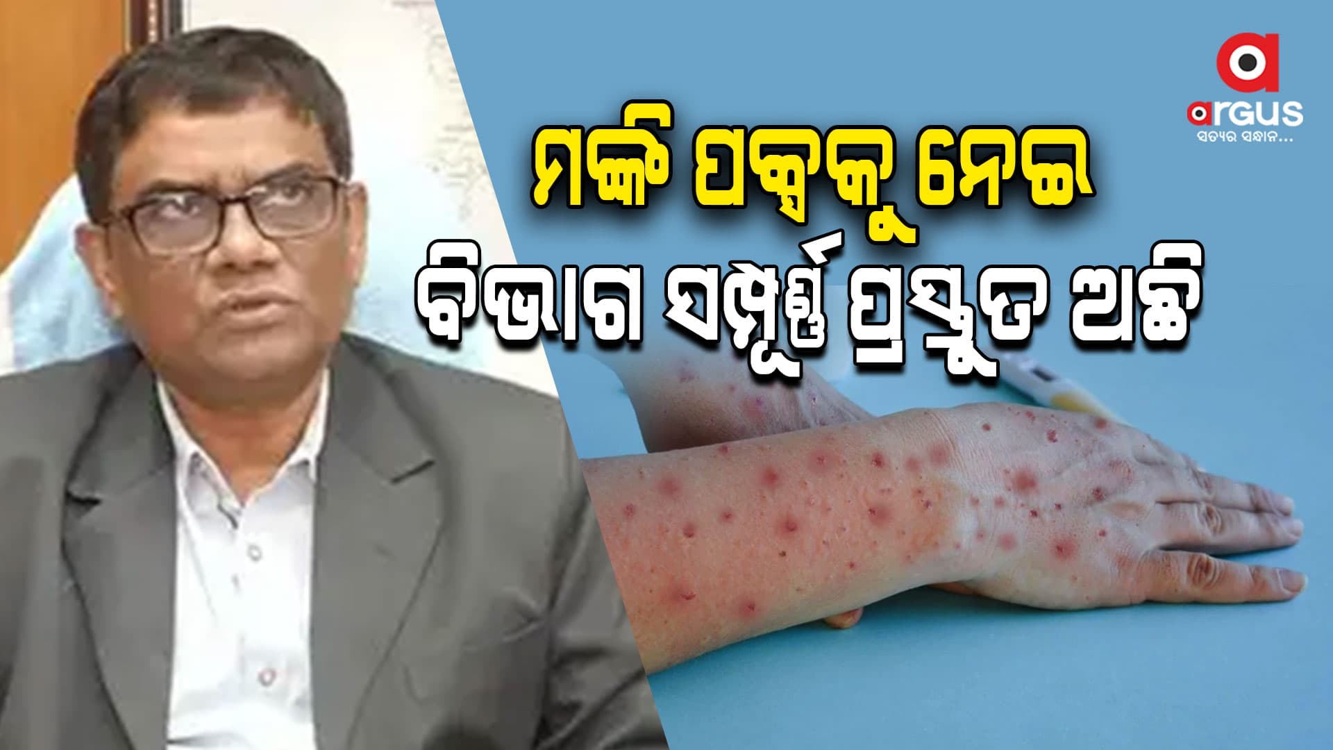 ମଙ୍କି ପକ୍ସକୁ ନେଇ ସ୍ୱାସ୍ଥ୍ୟ ନିର୍ଦ୍ଦେଶକଙ୍କ ପ୍ରତିକ୍ରିୟା, କହିଲେ ବିଭାଗ ପ୍ରସ୍ତୁତ ଅଛି