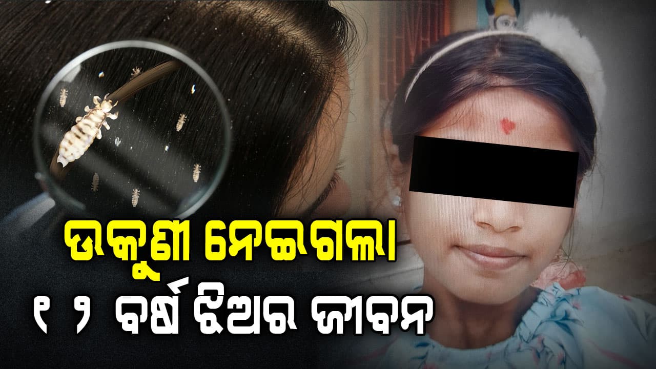 ମୁଣ୍ଡରେ ଉକୁଣୀ ପାଇଁ ଚାଲିଗଲା କୁନି ଝିଅର ଜୀବନ
