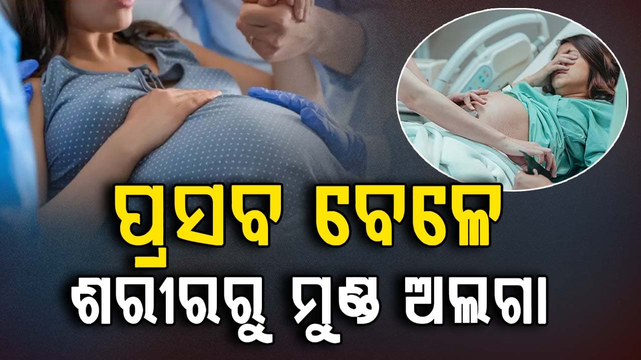 ପ୍ରସବ ସମୟରେ ନବଜାତ ଶିଶୁର ଶରୀରରୁ ମୁଣ୍ତ ଅଲଗା
