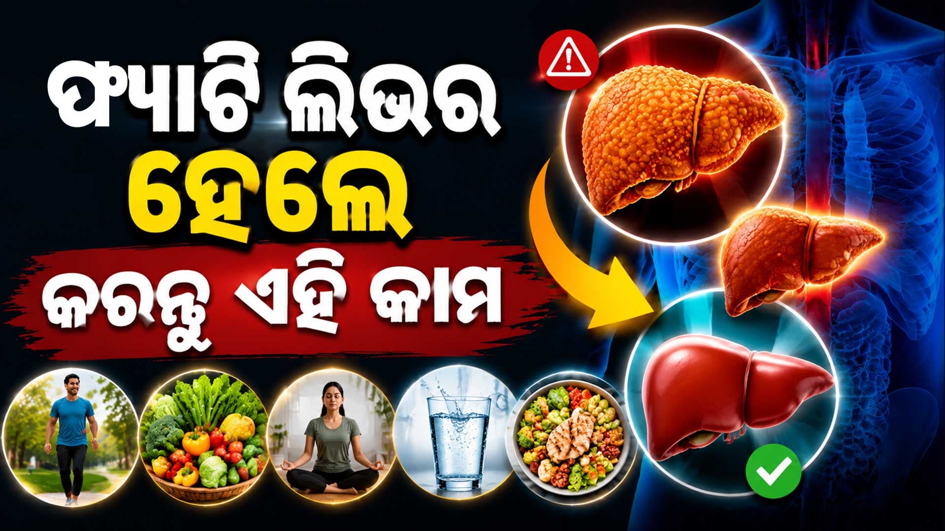 ଫ୍ୟାଟି ଲିଭରରୁ ମୁକ୍ତି ପାଇବେ କେମିତି ? ଜାଣନ୍ତୁ ଏହି ୫ ଉପାୟ