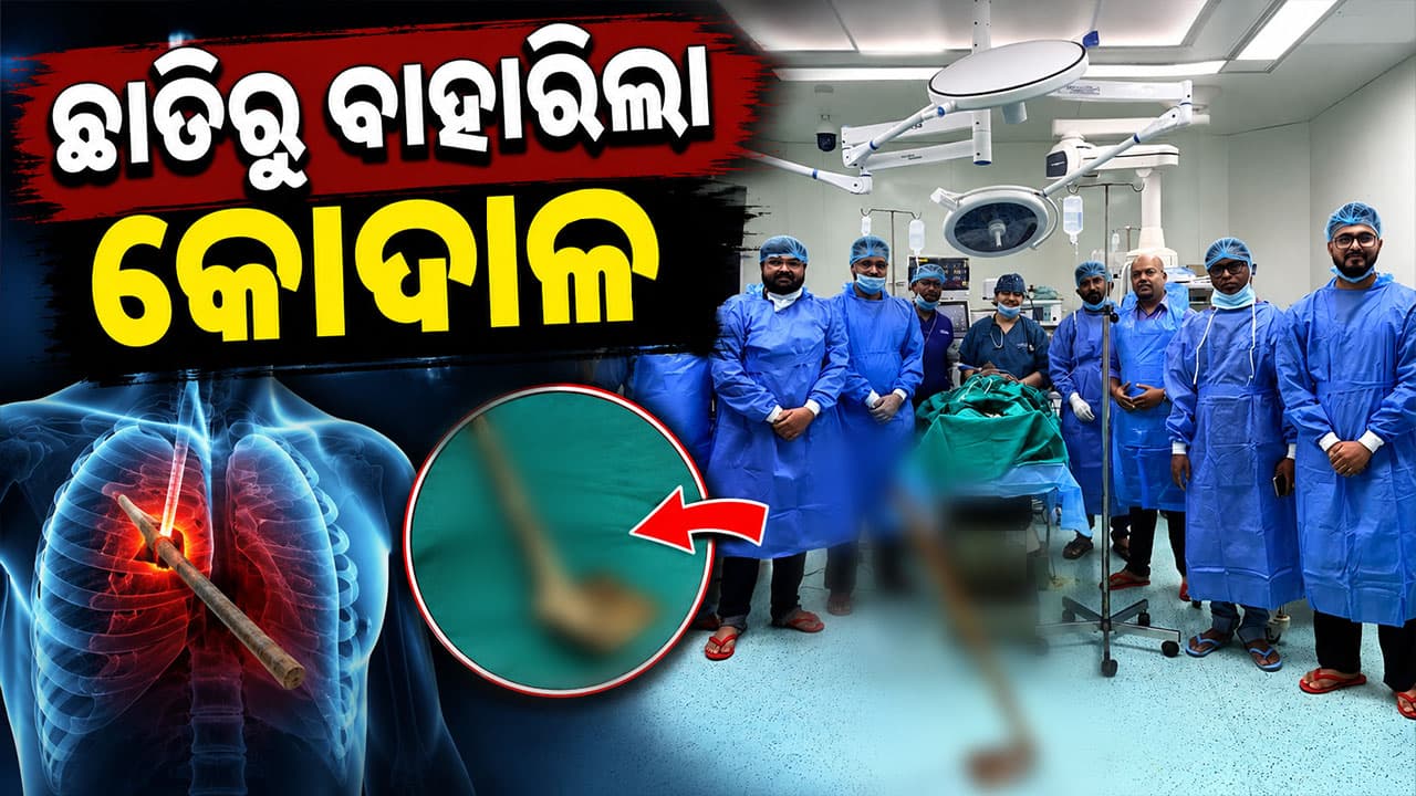 ଭୀମ ଭୋଇ ମେଡିକାଲ କଲେଜରେ ଅସ୍ତ୍ରୋପଚାର, ଛାତିରୁ ବାହାରିଲା କୋଦାଳ