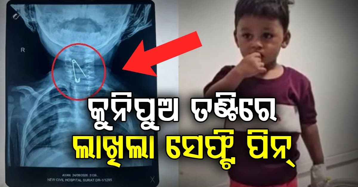 ଖେଳୁ ଖେଳୁ ସେଫ୍ଟି ପିନ୍ ଗିଳିଦେଲା କୁନିପୁଅ; ଏମିତି ବଞ୍ଚିଲା ଜୀବନ