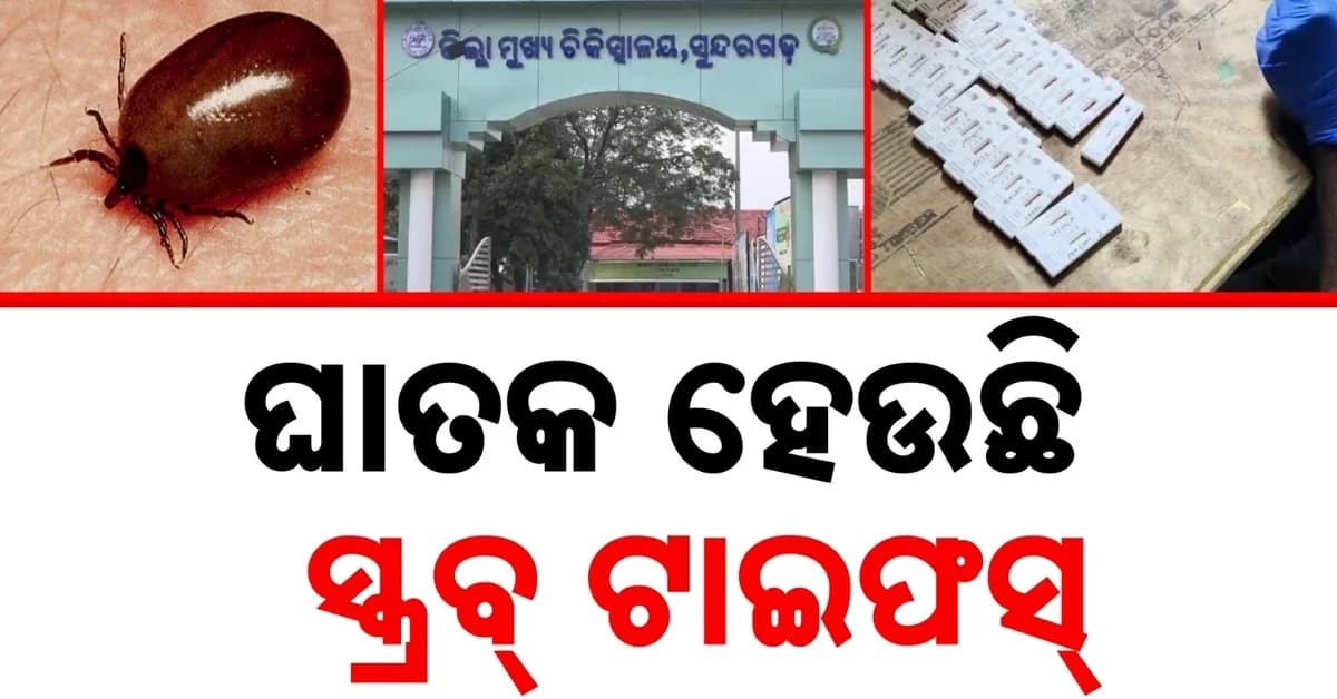ସୁନ୍ଦରଗଡ଼ରେ ଥମୁନି ସ୍କ୍ରବ୍ ଟାଇଫସ୍, ଆକ୍ରାନ୍ତଙ୍କ ସଂଖ୍ୟା ୯୧୦କୁ ବୃଦ୍ଧି