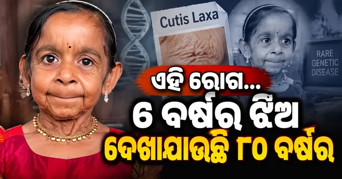 ୬ ବର୍ଷର ଝିଅ ଦେଖାଯାଉଛି ୮୦ ବର୍ଷର ବୃଦ୍ଧଙ୍କ ଭଳି, ଜାଣନ୍ତୁ କେଉଁ ରୋଗରେ ପୀଡ଼ିତ