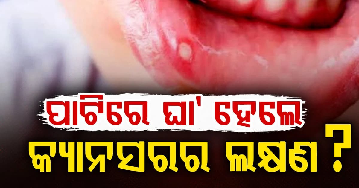 ପାଟି ଘା ହୋଇପାରେ କ୍ୟାନସର: ଜାଣନ୍ତୁ ଏହାର ଲକ୍ଷଣ ଏବଂ ନିରାକରଣ ?