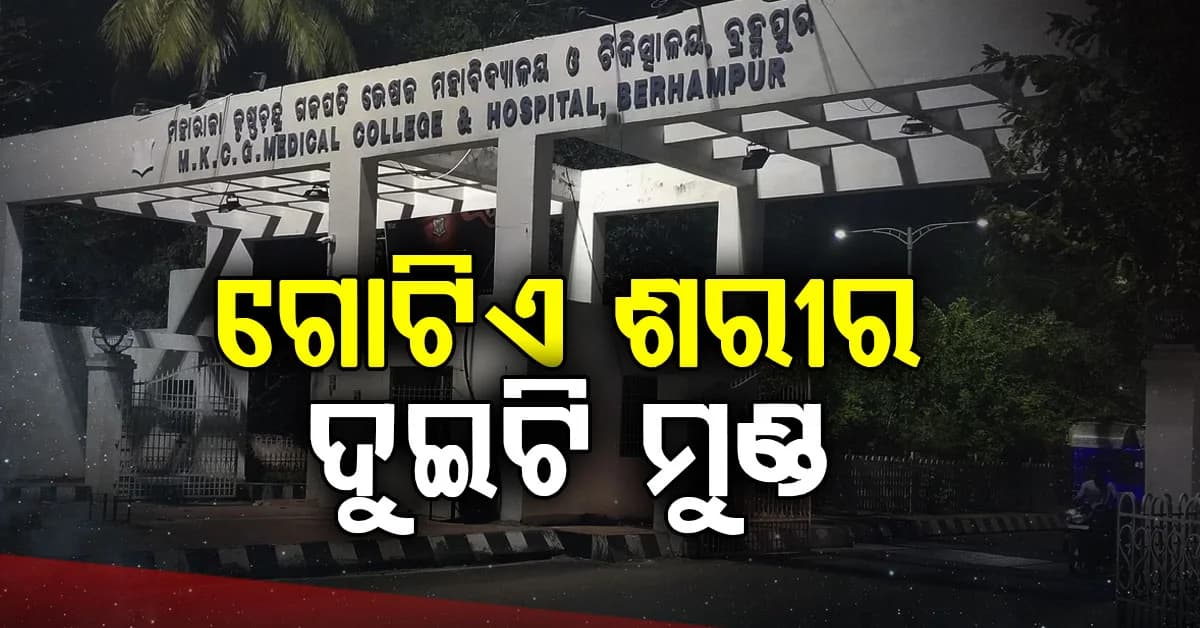 ବିରଳ ଯୋଡ଼ାମୁଣ୍ଡ ଶିଶୁ ଜନ୍ମ; ଗୋଟିଏ ଶରୀରରେ ରହିଛି ଦୁଇଟି ମୁଣ୍ଡ, ଦୁଇଟି ଛାତି