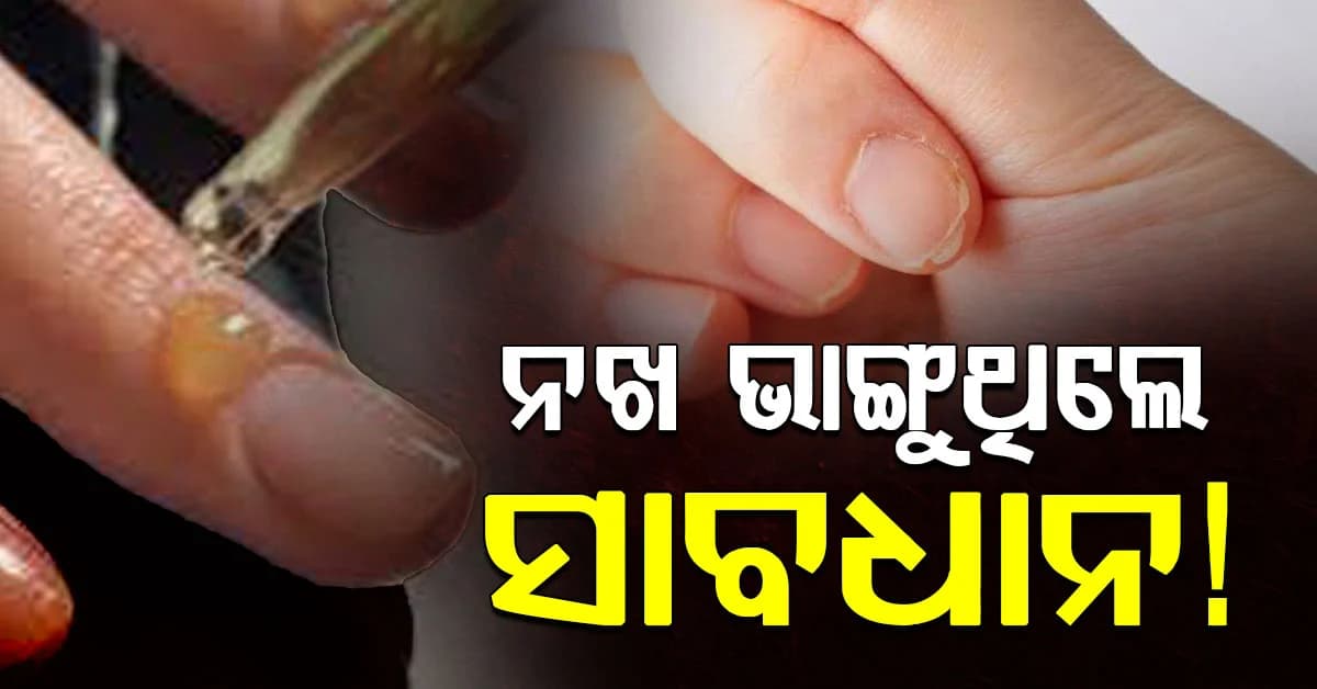 ନଖ ବାରମ୍ବାର ଭାଙ୍ଗୁଛି କି? ଶରୀରରେ ଏହି ଭିଟାମିନ୍ର ଅଭାବ ସହ ବଡ଼ ରୋଗ ହୋଇପାରେ