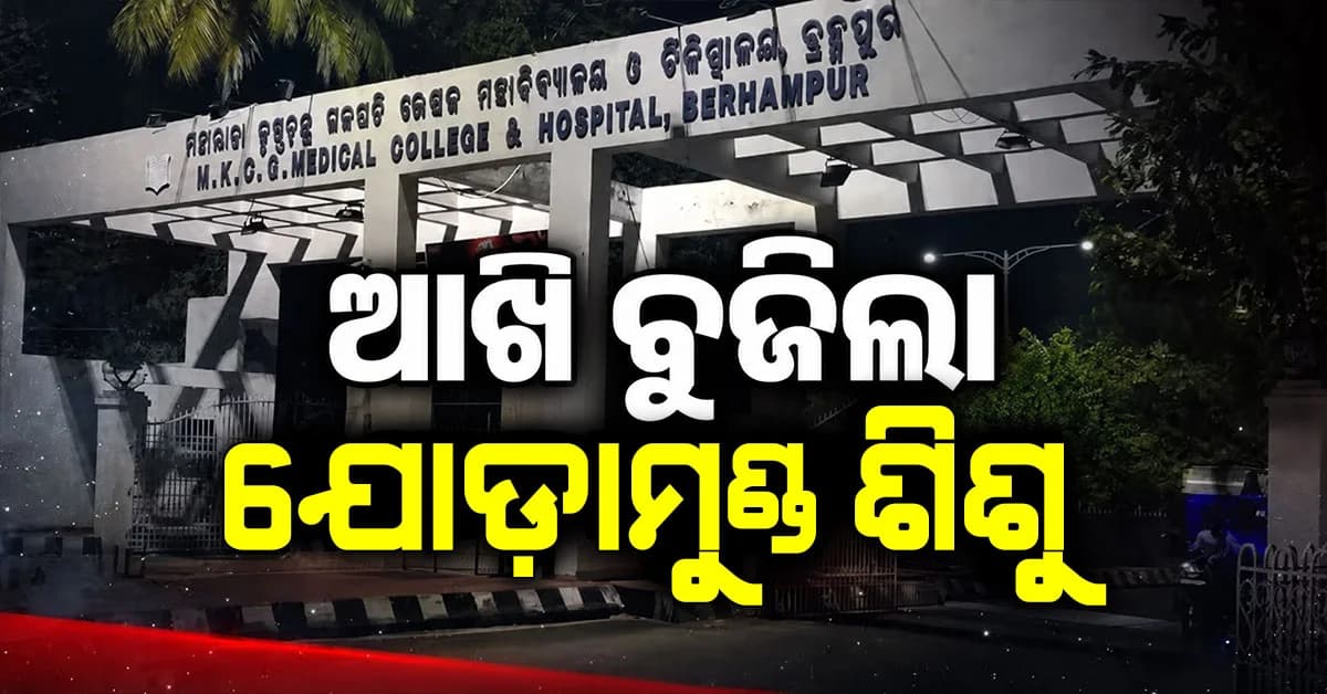 MKCGରେ ଆଖି ବୁଜିଲା ଯୋଡ଼ାମୁଣ୍ଡ ଶିଶୁ, ଜନ୍ମର ୭ ଦିନ ପରେ ଗଲା ଜୀବନ