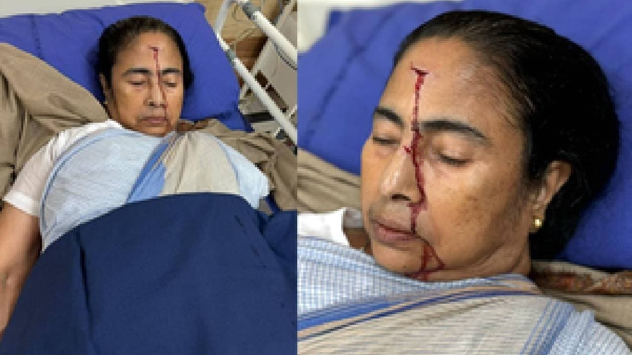 Mamata Banerjee Suffers 'Major' Injury, Rushed To Hospital: TMC