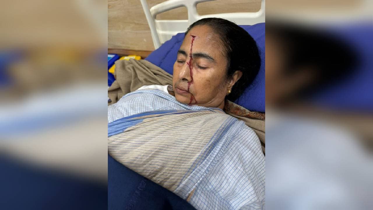 CM’s Injury A Result Of Syncope, Explains Prominent Doctor And Trinamool Minister Panja