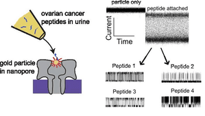 New Method May Detect Early Ovarian Cancer From Urine Test