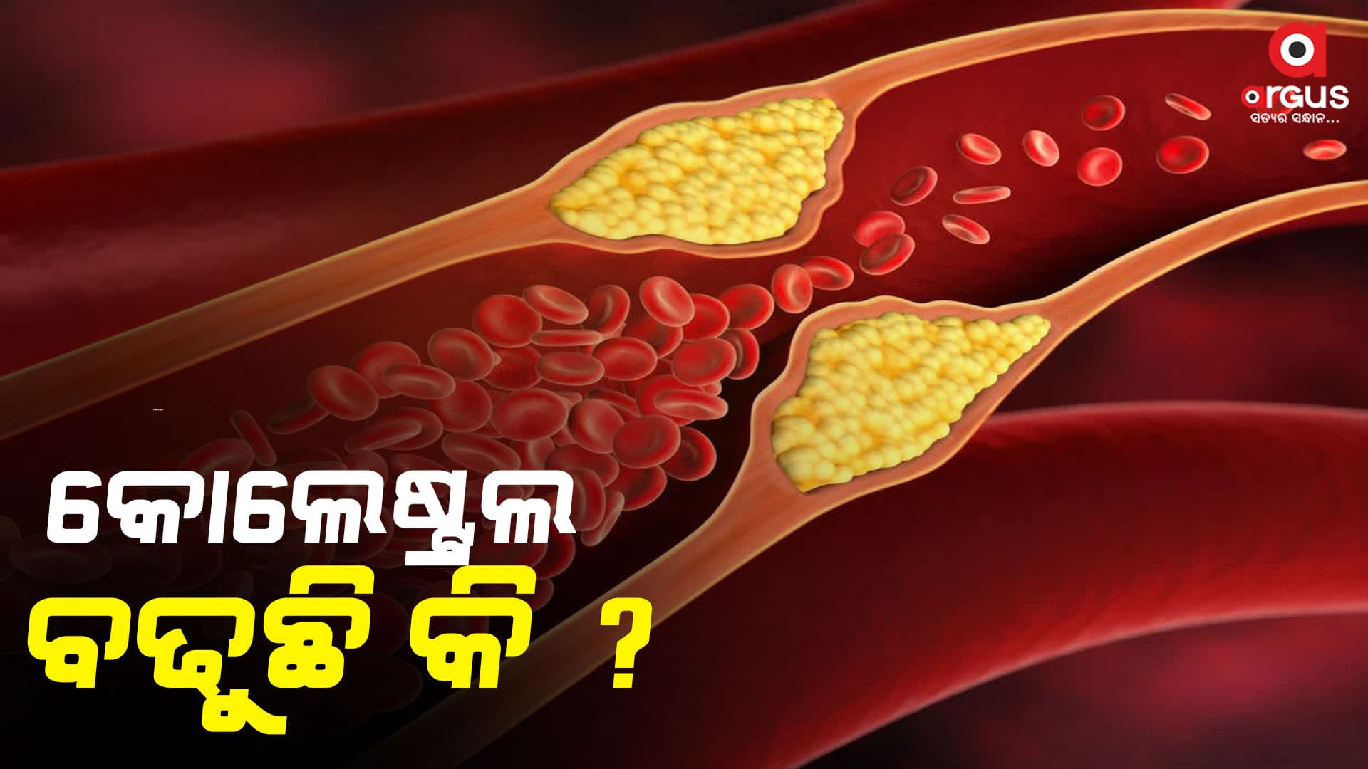 କୋଲେଷ୍ଟ୍ରଲକୁ ନିୟନ୍ତ୍ରଣରେ ରଖିଵେ କେମିତି ?